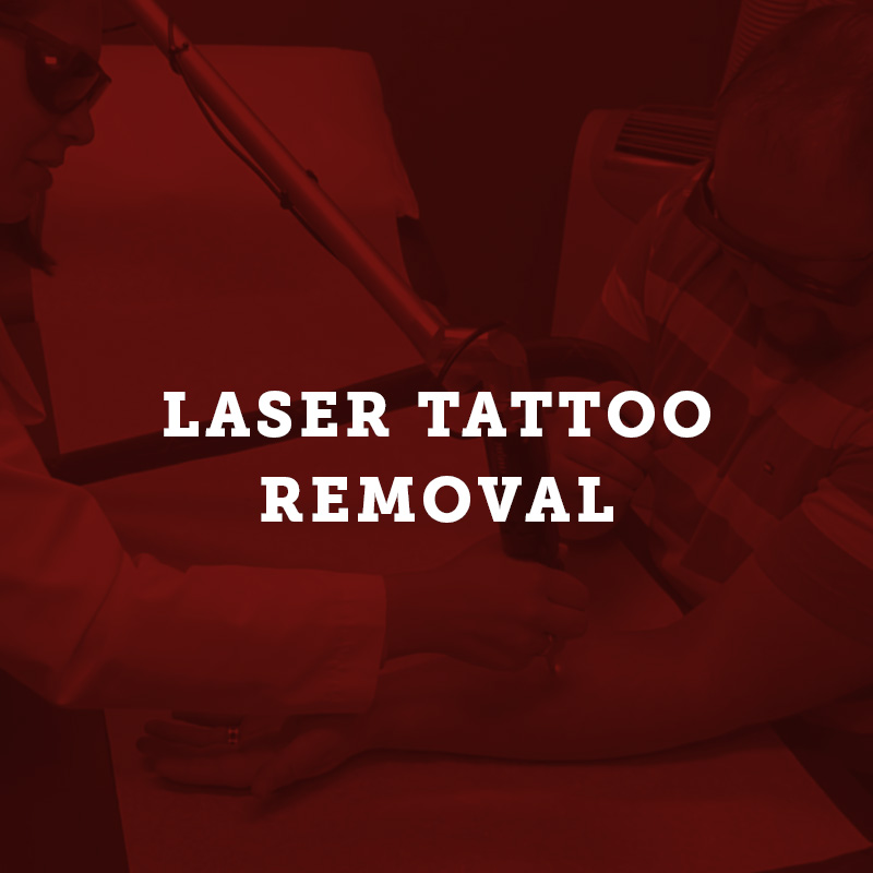 Advanced Laser Tattoo Removal Buffalo, NY The Skin Center