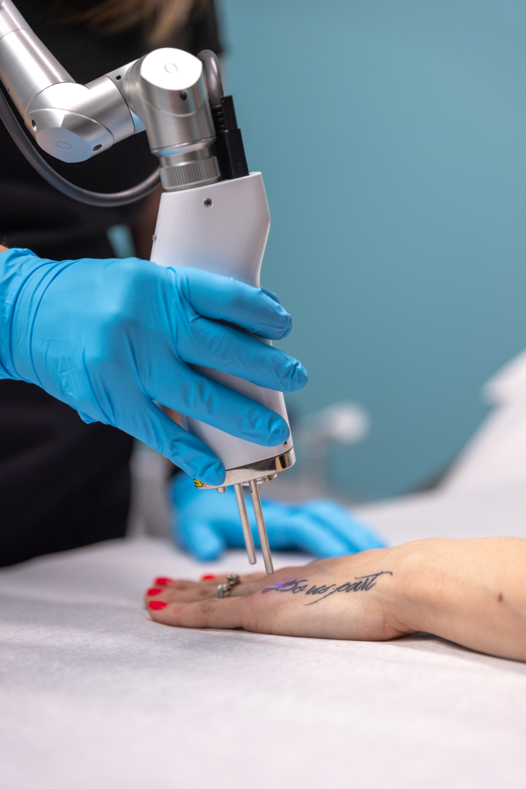 Advanced Laser Tattoo Removal Buffalo, NY The Skin Center