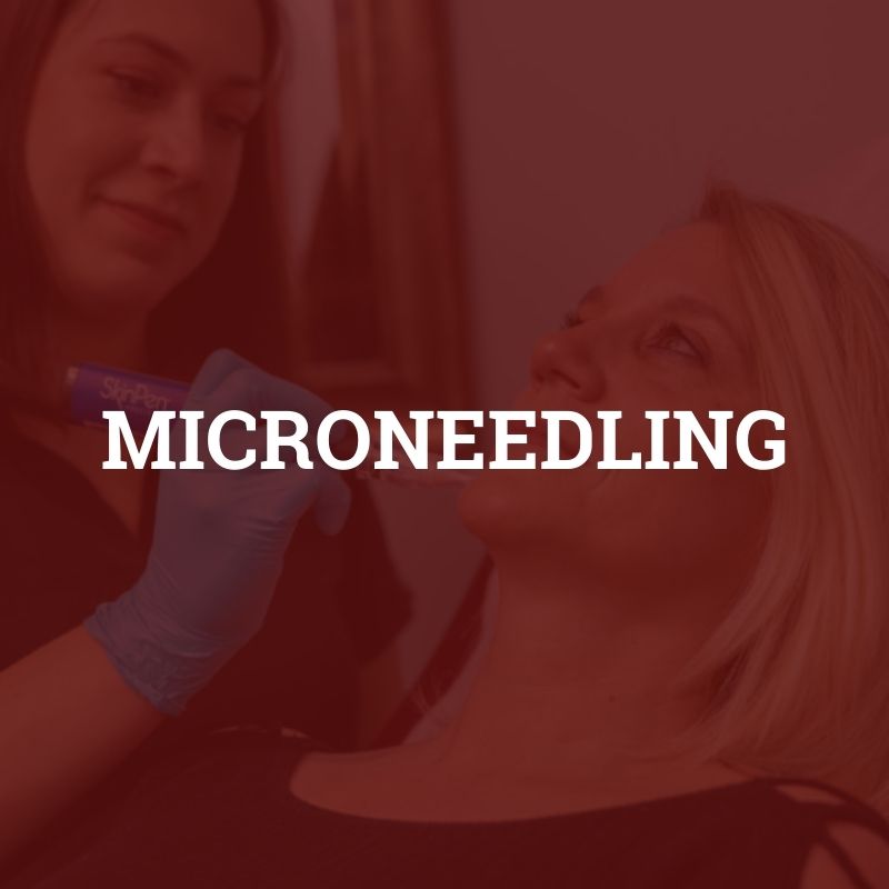 microneedling services